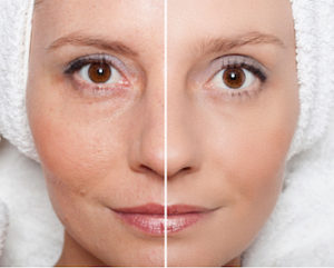 Beauty concept - skin care, anti-aging procedures, rejuvenation, lifting, tightening of facial skin