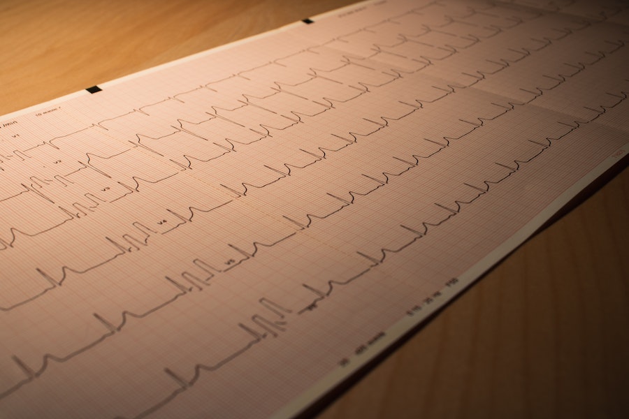 Blok 2 ekg 02